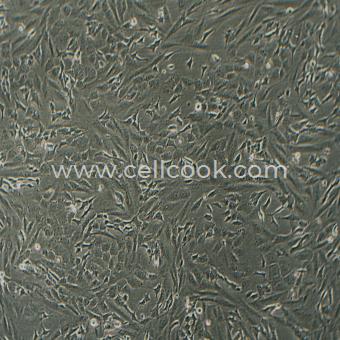 SK-N-SH人神經(jīng)母細胞瘤細胞（STR鑒定正確）