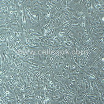 SW579人甲狀腺鱗癌細胞（STR鑒定正確）