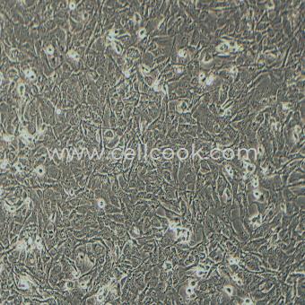 KHM-5M人甲狀腺癌細胞（退行性）（STR鑒定正確）