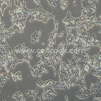 TT人甲狀腺導(dǎo)管癌細胞（髓樣癌）（STR鑒定正確）