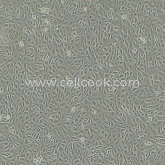 TPC-1人甲狀腺癌細(xì)胞（乳頭狀）（STR鑒定正確）