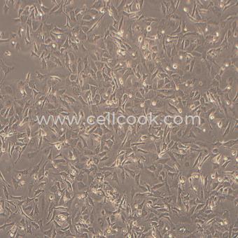 HS766T人胰腺癌細(xì)胞（STR鑒定正確）