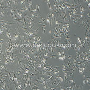 GBC-SD人膽囊癌細(xì)胞（STR鑒定正確）