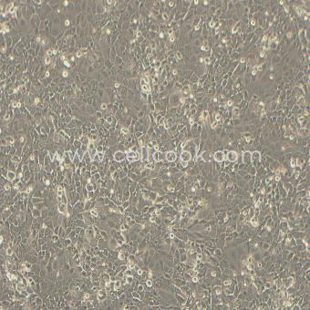 PK-59人胰腺癌細(xì)胞（STR鑒定正確）