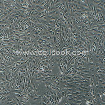 ARPE-19人視網(wǎng)膜上皮細(xì)胞（STR鑒定正確）