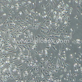 BEAS-2B人正常支氣管上皮細(xì)胞（STR鑒定正確）