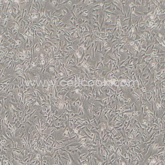 HS-5人永生化骨髓細(xì)胞（STR鑒定正確）