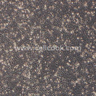 SVCT人永生化乳腺上皮細(xì)胞（STR鑒定正確）