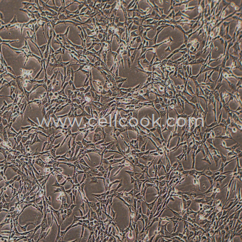 Pt67小鼠逆轉(zhuǎn)錄病毒包裝細(xì)胞（種屬鑒定正確）