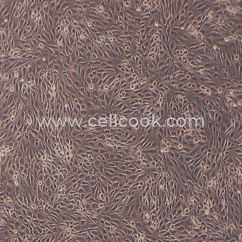 MS1小鼠胰島內(nèi)皮細(xì)胞（STR鑒定正確）