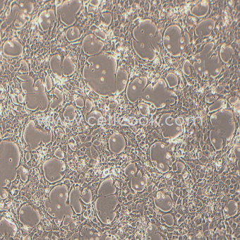 BNL CL.2小鼠胚胎肝細(xì)胞（種屬鑒定正確）