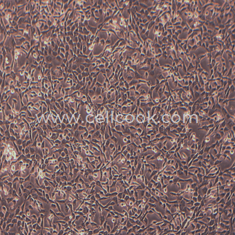 BNL 1ME A.7R.1小鼠肝瘤細(xì)胞（種屬鑒定正確）