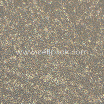 EMT6小鼠乳腺癌細(xì)胞（STR鑒定正確）