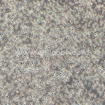 RBL-2H3大鼠嗜堿性粒細胞性白血病細胞（種屬鑒定正確）