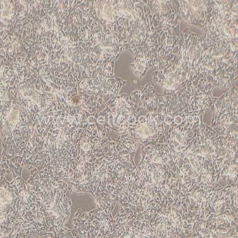 Hep G2-LUC示蹤穩(wěn)定細胞株（STR鑒定正確）