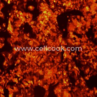 Hep G2-RFP示蹤穩(wěn)定細胞株（STR鑒定正確）