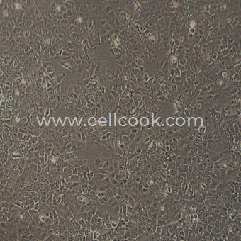 Huh-7-LUC示蹤穩(wěn)定細胞株（STR鑒定正確）