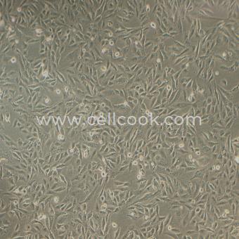 SNU-449人肝癌細(xì)胞（STR鑒定正確）