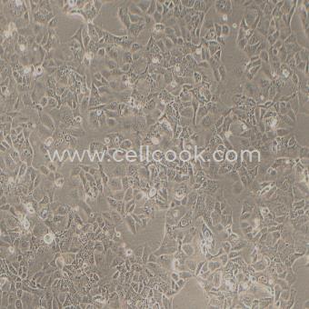 PLC/PRF/5人肝癌亞力山大細(xì)胞（STR鑒定正確）