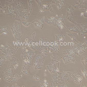 Li-7人肝癌細胞（STR鑒定正確）