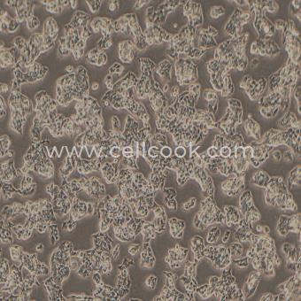 HepG2 2.2.15表達HBV病毒的人肝癌細胞（STR鑒定正確）