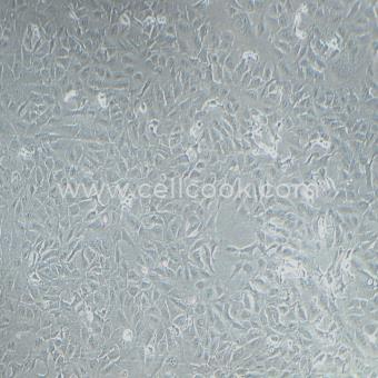 RBE人膽管細胞型肝癌細胞（STR鑒定正確）