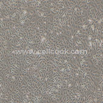 A549人非小細胞肺癌細胞（STR鑒定正確）