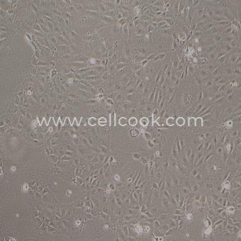 HUCC-T1人膽管上皮癌細胞（STR鑒定正確）