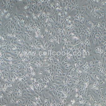 A549-LUC示蹤穩(wěn)定細胞株（STR鑒定正確）