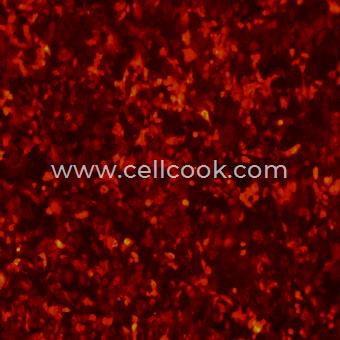 A549-RFP示蹤穩(wěn)定細胞株（STR鑒定正確）