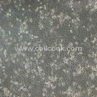 NCI-H1299人非小細胞肺癌細胞（STR鑒定正確）