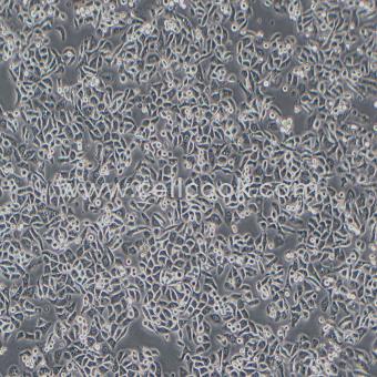 PC9人非小細胞肺癌細胞（STR鑒定正確）