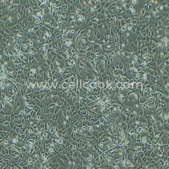 NCI-H1975-LUC示蹤穩(wěn)定細胞株（STR鑒定正確）