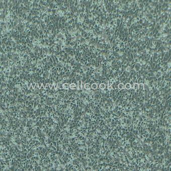 NCI-H460人大細胞肺癌細胞（STR鑒定正確）