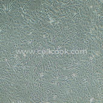 Calu-1人肺癌細胞（STR鑒定正確）