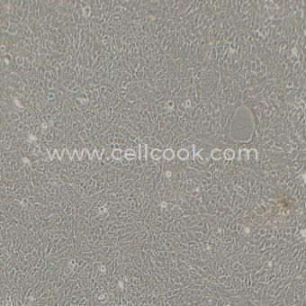 HCC827人非小細胞肺癌細胞（STR鑒定正確）