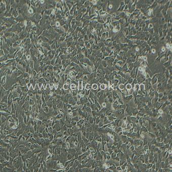 SK-MES-1人肺鱗癌細胞（STR鑒定正確）