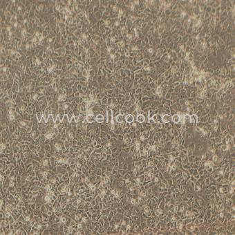 NCI-H23人非小細胞肺癌細胞（STR鑒定正確）