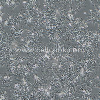 HCC4006人肺癌腺癌細胞（STR鑒定正確）