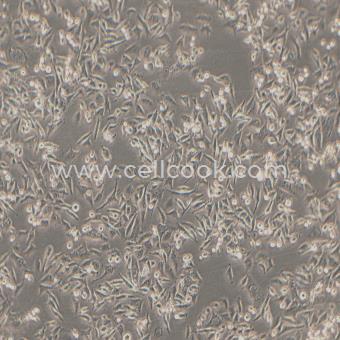 Calu-6人退行性肺癌細胞（STR鑒定正確）