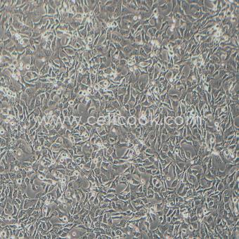 NCI-H2009人肺腺癌細胞（STR鑒定正確）