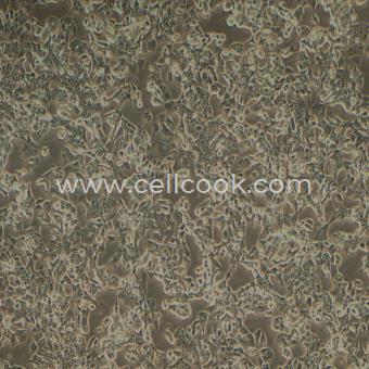 NCI-H2087人非小細胞肺腺癌細胞（STR鑒定正確）