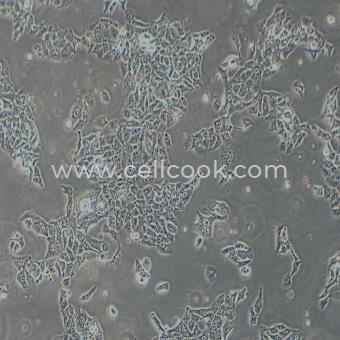 NCI-H441人肺腺癌細胞（STR鑒定正確）