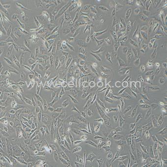 SK-Lu-1人低分化肺腺癌細胞（STR鑒定正確）