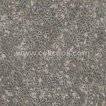 NCI-H2122人肺腺癌細胞（STR鑒定正確）