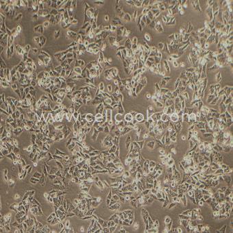 NCI-H1944人非小細(xì)胞肺癌細(xì)胞（STR鑒定正確）