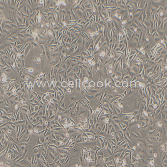 MDA-MB-231人乳腺癌細(xì)胞（STR鑒定正確）