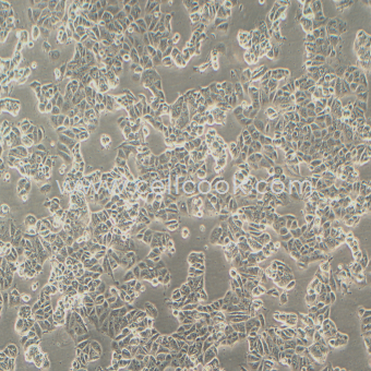 MCF7人乳腺癌細(xì)胞（STR鑒定正確）