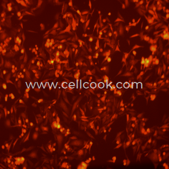 MDA-MB-231-RFP示蹤穩(wěn)定細胞株（STR鑒定正確）