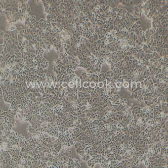 MCF7-LUC示蹤穩(wěn)定細胞株（STR鑒定正確）